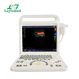USG Doppler Color 4D