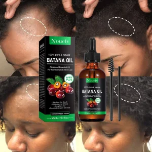Organic Hair Growth Serum With Herbal &amp; Tea Tree Oil Encourages Scalp Skincare Private Label Hair Oils for Hair Loss Prevention