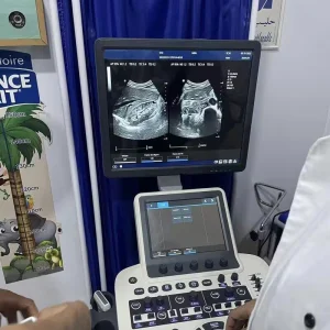 Monitor LCD de 3D/4D 15 pulgadas Sistema de Diagnóstico por Ultrasonido Doppler Color Médico