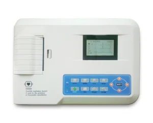 Monitor ECG inteligente