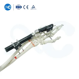 Factory Direct Supply Orthopaedic External Fixation Device, Ulna &amp; Radius External Fixator OEM ODM