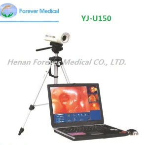 Ce Approved Portable Sony Colposcopy Systems for Gynecological (YJ-U150)