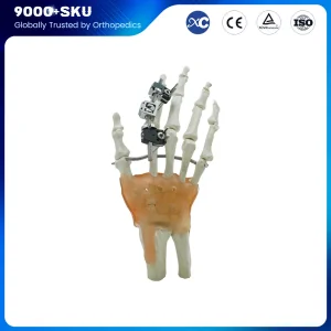 Finger External Fixator