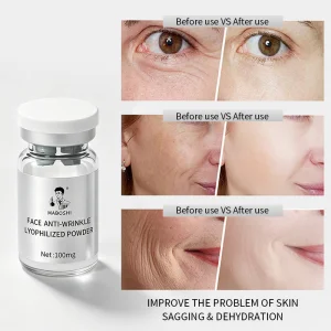 New Exosom Lyophilized Essence Repair Skin Barrier Retinol Niacinamide Even Skin Tone Collagen Brightening Anti-wrinkle Serum