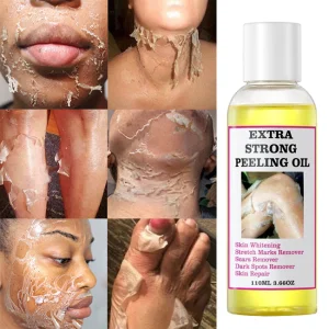OEM Organic Black Skin Lightening Whitening Peeling Oil Extra Strength Exfoliating Serum For Face Body Private Label 3-Year