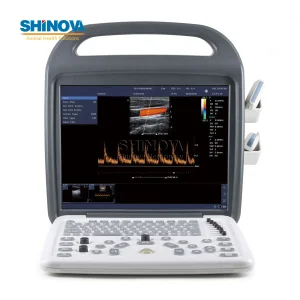 Shinova Portable Color Doppler Diagnostic Instrument for Veterinary Use