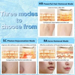 Dispositivo de Beleza para Remoção de Pelos por IPL