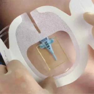 Disposable Medical IV Dressing Pad