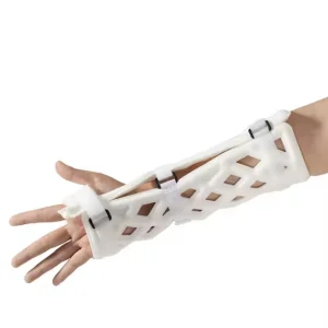 Portable Hand External Fixation System