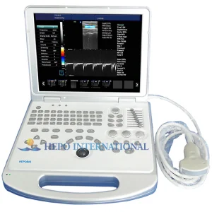Sistema de escáner ultrasónico Doppler color portátil popular ruso 2D 3D
