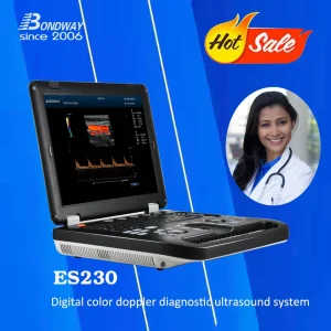 Sistema de Imagen Ultrasonido Doppler Color Digital para Laptop con 3D, 4D Función, Es230