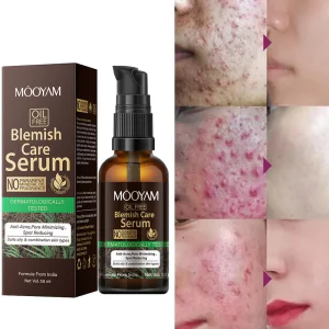 2023 Latest Skin Care OEM Acne Treatment Salicylic Acid Facial Efficient Acne Removal Solution