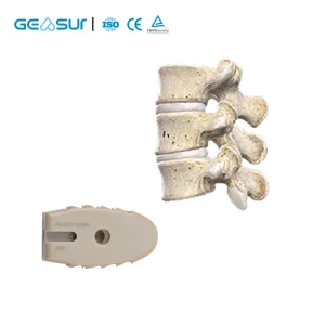 Geasure Orthopedic PEEK TLIF Cage Lumbar Interbody Fusion Cage for Spine Fixation Implant Surgery Wholesale