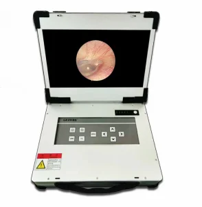 Endoscopic Imaging Light