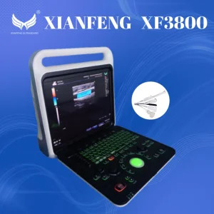 Cardiac Ultrasound