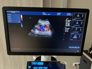 Dw-T50 Dual-Screen Cart-Based Color Doppler Ultrasound Diagnostic System with 4D Imaging