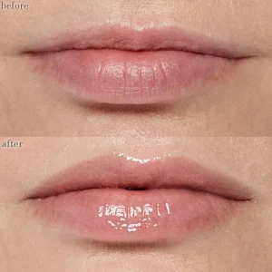 OEM Custom Lip Plumping Serum Booster Syringe with New Container Vegan Liquid Hyaluronic Acid Private Label Lip Plumper