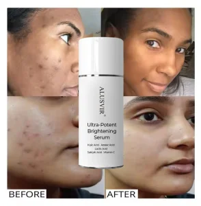 Oem Pigmentation Freckle Brightening Whiting Anti Aging Face Serum Skin Care Whitening Dark Spot Removal Corrector Serum Facial