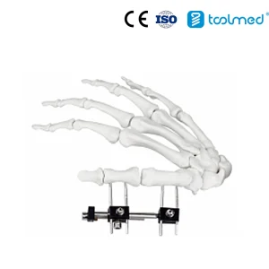 Combined Type Fixator