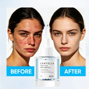 IREV Centella Niacinamide Serum