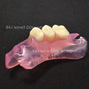 China Dental Lab Valplast Flexible Dentures