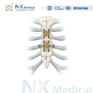 Sternum Implants System
