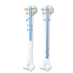 Osteoporotic Bone Fixation HCMC