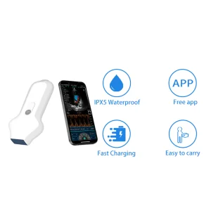 Ultrasound Probe Battery