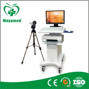 Electronic Handheld Colposcope