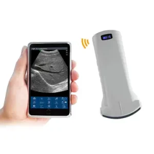Handheld Ultrasound Probe