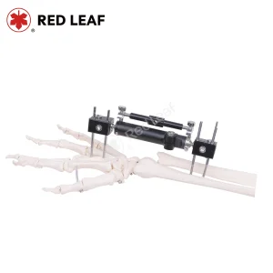 Wrist Fixator