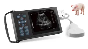 Handheld Ultrasound