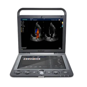 Escáner de Ultrasonido Doppler Color Vascular Cardíaco Portátil 3D 4D