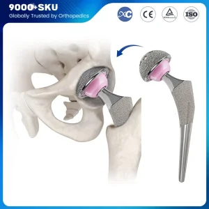 Total Hip Replacement