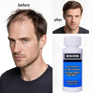 2025 Stock 6-in-1 Professional Herbal Nourishing Hair-Repairing Hair Care Kit Hair Growth Regrowth 5% Liquid Solution 60ml