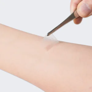Silicone Scar Sheet
