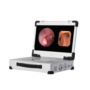 Factory Price Flexible and Rigid Endoscopic Camera System for Ent Equipment