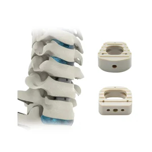 Geasure Medical-Grade PEEK Cervical Interbody Fusion Cage for Spinal Surgery
