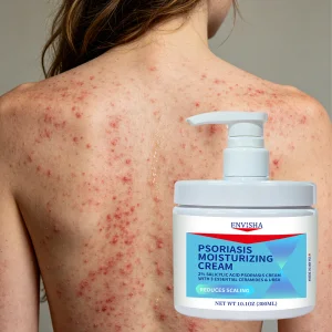 Psoriasis Moisturizing Cream