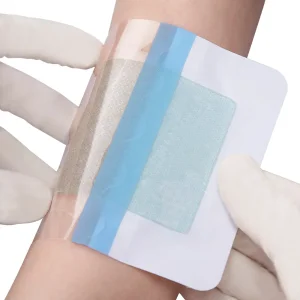 Sterile Surgical Dressing Hydrogel Burn Dressing for Wound Care