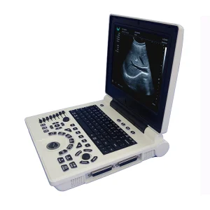 3D Ecografía Abdominal Escaneo Imagen Sonografía Ultrasonografía Sistema
