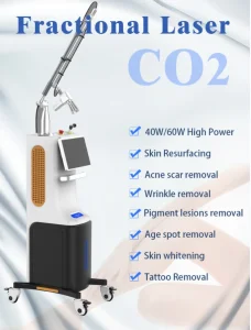 4D Laser Vaginal Tightening