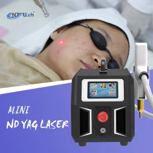 Portable Q Switched Nd Yag Laser Tattoo Remove Machine
