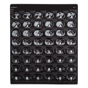 FUJI Printer Using Laser/Thermal Medical X-ray Film 35X43 Cm