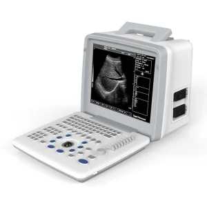 Ubw300 Máquina de ultrasonido portátil humana de bajo precio para instrumentos médicos