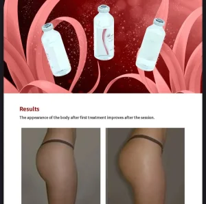 B-Esta Breast Enhancement