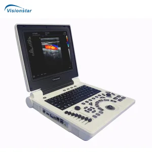 Ultrasound Equipment