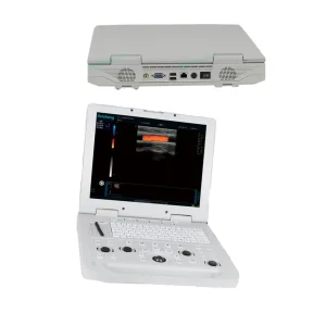 Hospital Ultrasound Machine