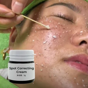 Quita Manchas Cream De Melasma