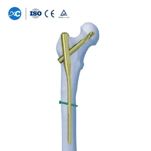 Titanium Femur Nail